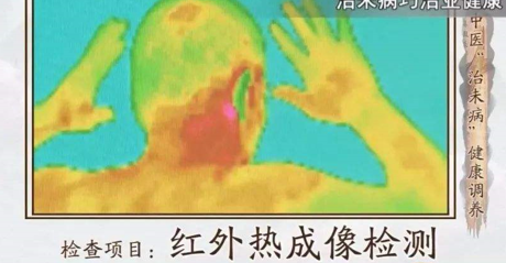 红外热成像应用于中医检查